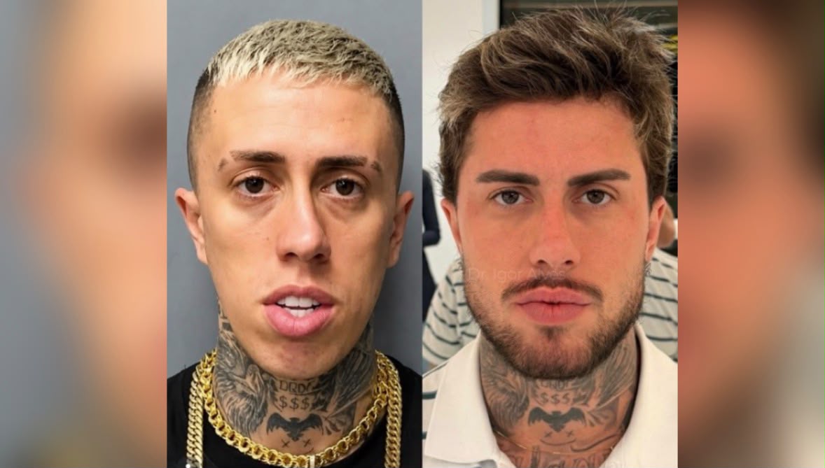 MC Daniel mostra transformação após procedimentos estéticos e repercute nas redes sociais
